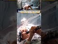 WATCH: Parkinson's patient plays clarinet DURING brain surgery #fox #news #foxnews #us #parkinsons